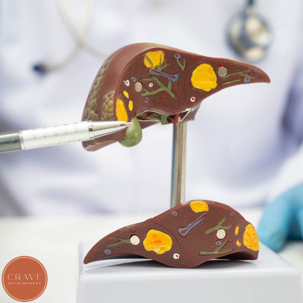 Recently, experts have updated the term to Metabolic Dysfunction-Associated Steatotic Liver Disease (MASLD) to better reflect the condition's underlying drivers. Rather than focusing on what the disease is not, the new name highlights the important role that metabolic factors such as insulin resistance, elevated blood sugar, excess body fat, and other metabolic health concerns play in the development of fatty liver.