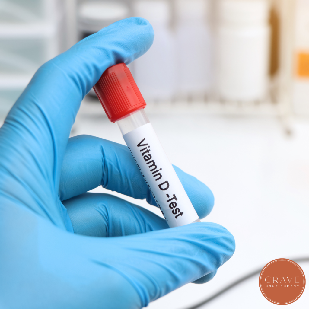If you have lipedema, it may be worth asking your healthcare provider about checking your vitamin D level, particularly if you're preparing for lipedema surgery or have risk factors for deficiency. If your levels stay low despite doing everything right, genetic testing may help explain why.